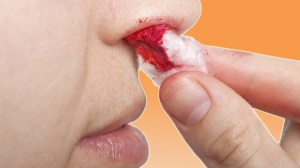 dnews--1787--why-do-we-get-nosebleeds--large.thumb